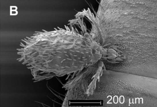 Leptus killingtoni en microscopie électronique issu du travail scientifique cité en -1-